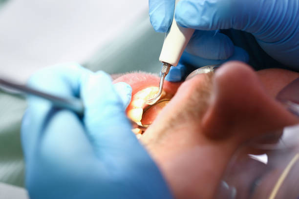 Best Emergency Tooth Extraction in Shiner, TX